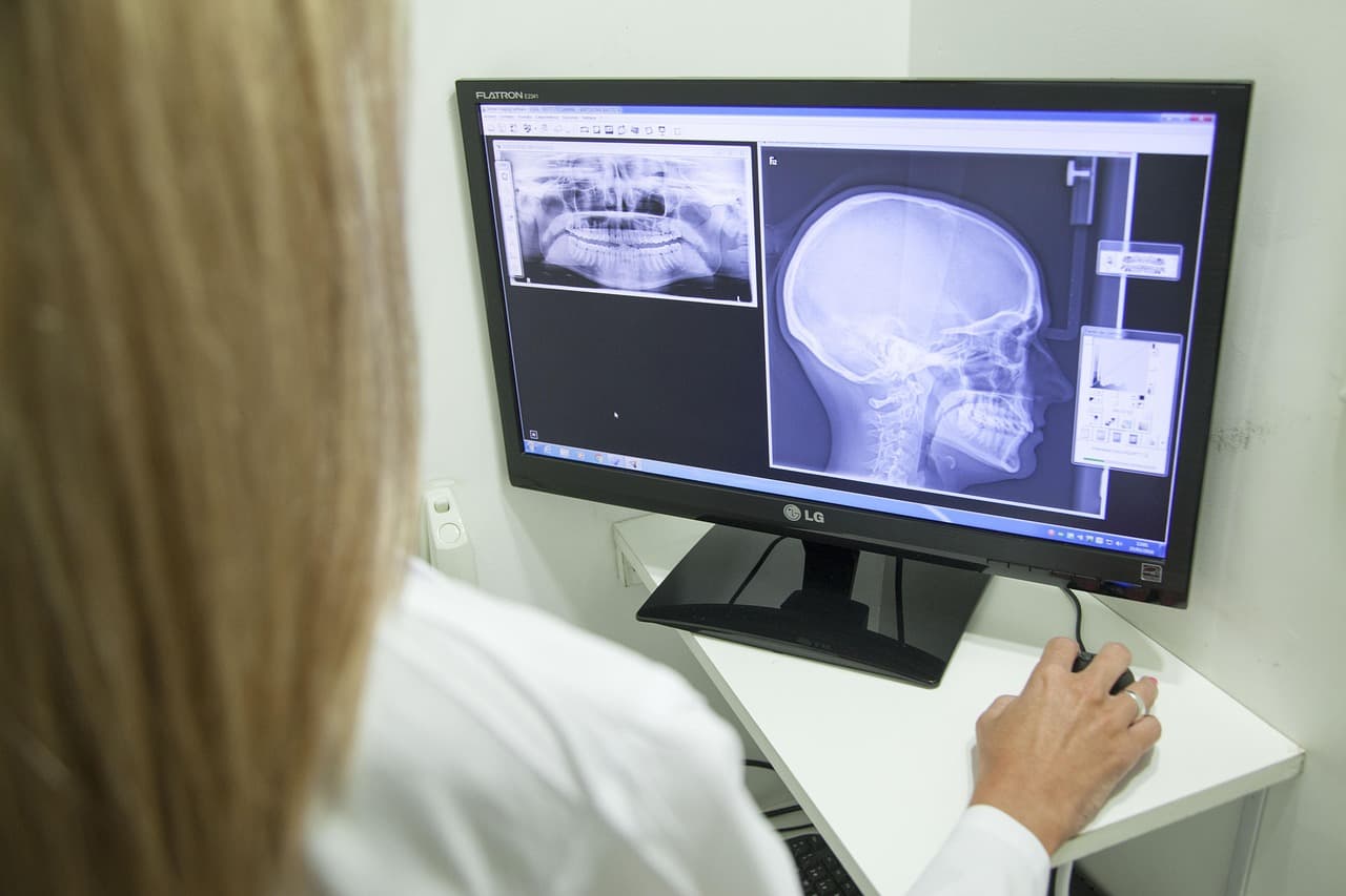Radiologists' work will not disappear soon because of AI — it will rather transform