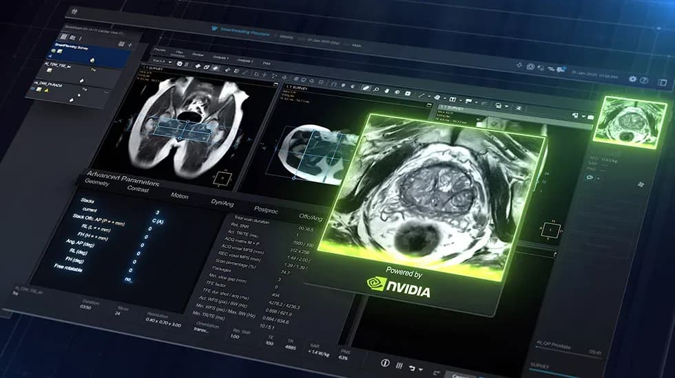 NVIDIA releases open-source model to generate synthetic 3D brain MRIs
