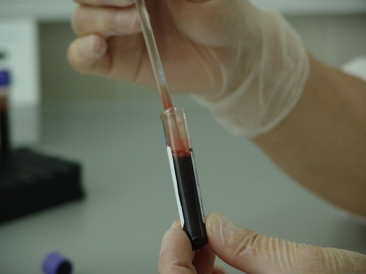 AI framework PULSE predicts 251 metabolomic biomarkers from 61 routine blood tests